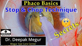 Phaco Basics  Stop amp Chop technique Re visited  Dr Deepak Megur [upl. by Sackman688]