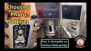 Phaco Fundamentals Part 3 Peristaltic vs Venturi Pumps in Cataract Surgery [upl. by Nelg]