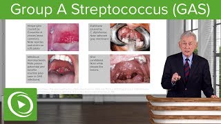 Group A Streptococcus GAS – Infectious Diseases  Lecturio [upl. by Sugirdor302]