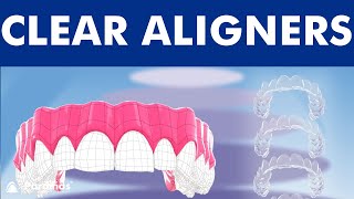 INVISALIGN  Orthodontic treatment with CLEAR ALIGNERS © [upl. by Major]