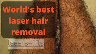 Worlds best hair removal laser [upl. by Araed948]