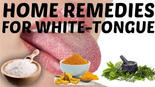 Easy Home Remedies to Get Rid of White Coated Tongue [upl. by Rodina]