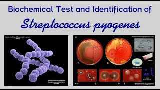 Pharyngitis Part 2 Bacterial Pharyngitis Streptococcus Pyogenes [upl. by Louella626]