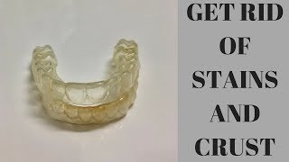 How To Clean Your Retainers [upl. by Knudson]