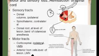 ipsilateral contralateral [upl. by Mirabel]