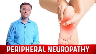 How to Relieve Peripheral Neuropathy Pain – Dr Berg [upl. by Johst]