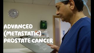 About Advanced Metastatic Prostate Cancer [upl. by Aennil915]