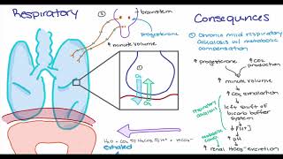 Hypertensive disorders in Pregnancy [upl. by Nylyaj]