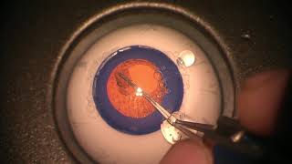 Simulated Surgery Phacoemulsification Creating Incision and Performing a Capsulorhexis [upl. by Udella]