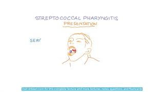 Streptococcus Pyogenes  Diseases and Their Management [upl. by Meagher]