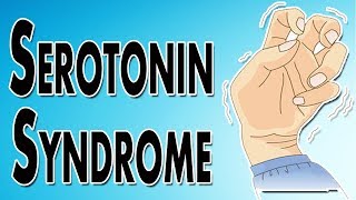 Managing Serotonin Syndrome [upl. by Aurelie]