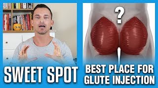 Best Place For Glute Injection  The Sweet Spot [upl. by Rockwell]