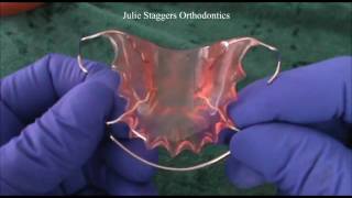 Care of Orthodontic Retainers [upl. by Pokorny]