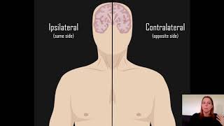 Ipsilateral vs Contralateral [upl. by Radack320]