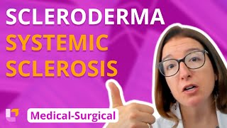 7 facts about Scleroderma  a Rheumatologist explains [upl. by Longo]