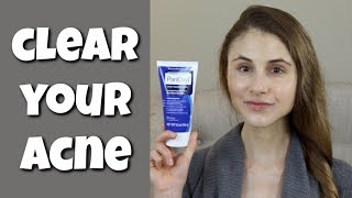 HOW TO CLEAR YOUR SKIN WITH BENZOYL PEROXIDE DR DRAY [upl. by Rebane844]