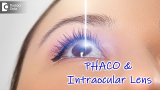 All about PHACO Eye Surgery  Procedue Explained by Expert  Dr Sriram Ramalingam  Doctors Circle [upl. by Derreg348]