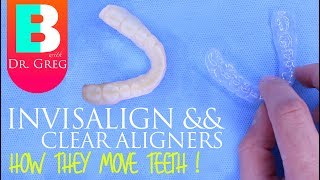 How Invisalign Works  How Clear Aligners Work [upl. by Eelessej]