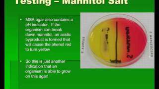 Introduction to Streptococcus [upl. by Aniretak]