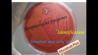 Streptococcus pyogenes identification [upl. by Franciscka]