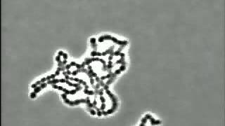 Bacteria Streptococcus pyogenes [upl. by Halpern]