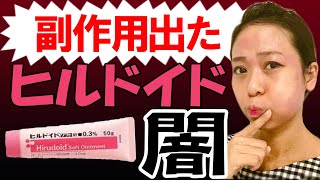 【ヒルドイドの闇】使い続けた結果…アトピー悪化。添付文を簡単に解説 [upl. by Clement677]