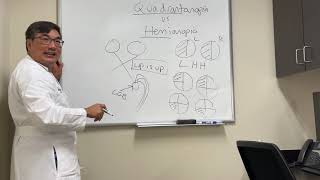 Quadrantanopia vs hemianopia [upl. by Conlen]