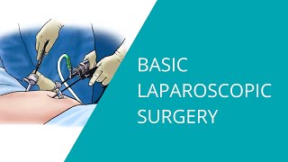 BASIC SETUP EXPLORATORY LAPAROTOMY [upl. by Rissa]