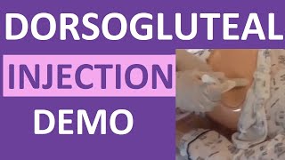 How to Give an IM Intramuscular injection in the Buttocks  Dorsogluteal Hip Injection Technique [upl. by Hedvig]