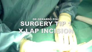 BASIC SET UP EX LAPAROTOMY [upl. by Ashli382]