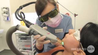 Laser Hair Removal  How does it work [upl. by Pass]