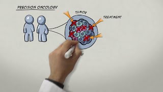 Lung Metastasis  All Symptoms [upl. by Tonya]