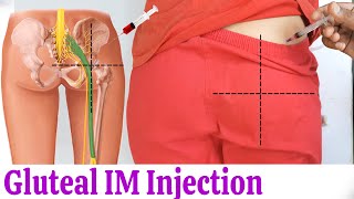 How to give IM Intramuscular injection in buttock or hip easily at home  Dorsogluteal Injection [upl. by Jabe]